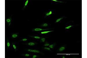 Immunofluorescence of monoclonal antibody to RCC1 on HeLa cell. (RCC1 抗体  (AA 312-421))