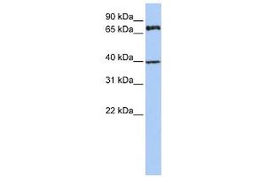 Western Blotting (WB) image for anti-Membrane Protein, Palmitoylated 5 (MAGUK P55 Subfamily Member 5) (MPP5) antibody (ABIN2458687) (MPP5 抗体)