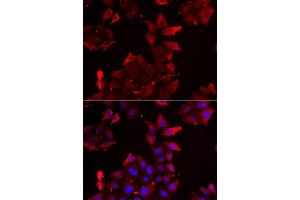 Immunofluorescence analysis of U2OS cells using PDLIM1 antibody (ABIN5974031). (PDLIM1 抗体)