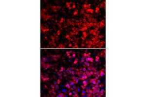 Immunofluorescence analysis of U2OS cells using QARS antibody. (QARS 抗体  (AA 1-250))