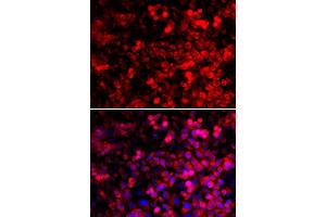 Immunofluorescence analysis of U2OS cells using QARS antibody. (QARS 抗体  (AA 1-250))