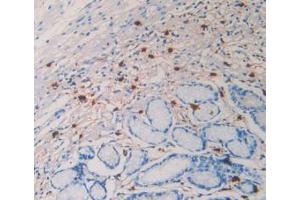 IHC-P analysis of Human Stomach Tissue, with DAB staining. (TPSAB1 抗体  (AA 161-262))