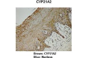 Sample Type : Monkey vagina  Primary Antibody Dilution :  1:25  Secondary Antibody: Anti-rabbit-HRP  Secondary Antibody Dilution:  1:1000  Color/Signal Descriptions: Brown: CYP21A2 Blue: Nucleus  Gene Name: CYP21A2  Submitted by: Jonathan Bertin, Endoceutics Inc. (CYP21A2 抗体  (C-Term))