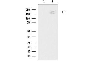 Western blot analysis of lysates from K562 cells(serum starvation treatment), using AKAP12 Antibody.