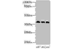 Western blot All lanes: HNRNPD antibody at 2 μg/mL Lane 1: 293T whole cell lysate Lane 2: Hela whole cell lysate Lane 3: Jurkat whole cell lysate Secondary Goat polyclonal to rabbit IgG at 1/10000 dilution Predicted band size: 39, 37, 33, 31 kDa Observed band size: 39 kDa (HNRNPD/AUF1 抗体  (AA 18-355))