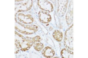 Immunohistochemistry of paraffin-embedded rat kidney using NEURL1B Rabbit pAb (ABIN7268857) at dilution of 1:100 (40x lens).