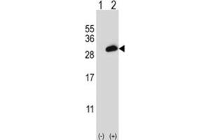 Western Blotting (WB) image for anti-Proteasome (Prosome, Macropain) Activator Subunit 2 (PA28 Beta) (PSME2) antibody (ABIN3002751) (PSME2 抗体)