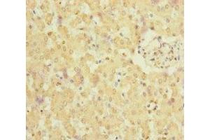 Immunohistochemistry of paraffin-embedded human liver tissue using ABIN7165719 at dilution of 1:100 (NELL1 抗体  (AA 160-420))