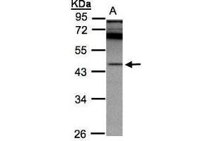 WB Image Sample(30 ug whole cell lysate) A:A431, 10% SDS PAGE antibody diluted at 1:2000 (SCPEP1 抗体)