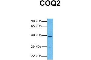 Host:  Rabbit  Target Name:  COQ2  Sample Tissue:  Human MCF7  Antibody Dilution:  1. (COQ2 抗体  (Middle Region))