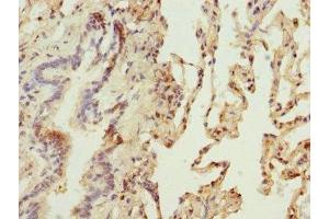 Immunohistochemistry of paraffin-embedded human lung tissue using ABIN7159816 at dilution of 1:100 (OGN 抗体  (AA 20-298))