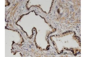 Immunoperoxidase of monoclonal antibody to ZHX3 on formalin-fixed paraffin-embedded human prostate.