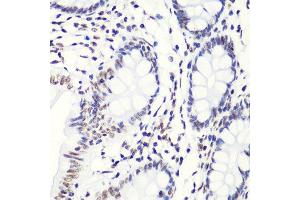 Immunohistochemistry of paraffin-embedded human colon using H4K20me2 antibody.