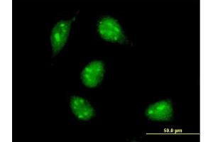 Immunofluorescence of monoclonal antibody to MAX on HeLa cell. (MAX 抗体  (AA 1-151))