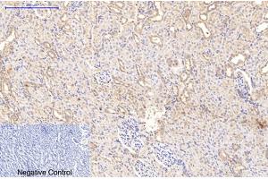 Immunohistochemical analysis of paraffin-embedded rat kidney tissue. (Collagen Type I 抗体)