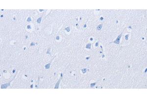 Immunohistochemistry of paraffin-embedded using KCNMB3 Polyclonal Antibody at dilution of 1: (KCNMB3 抗体)