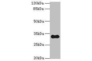 Western blot All lanes: TMEM53 antibody at 5 μg/mL + Mouse brain tissue Secondary Goat polyclonal to rabbit IgG at 1/10000 dilution Predicted band size: 32, 24 kDa Observed band size: 32 kDa (TMEM53 抗体  (AA 1-170))