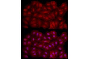 Immunofluorescence (IF) image for anti-Sirtuin 1 (SIRT1) antibody (ABIN7270322)