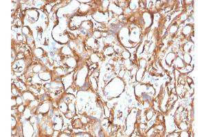 Formalin-fixed, paraffin-embedded human Placenta stained with Ezrin Mouse Monoclonal Antibody (CPTC-Ezrin-1). (Ezrin 抗体)