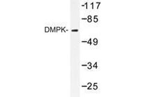 Western blot analysis of DMPK antibody in extracts from Jurkat cell. (DMPK 抗体)