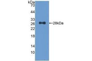 Detection of Recombinant CDK9, Human using Polyclonal Antibody to Cyclin Dependent Kinase 9 (CDK9)