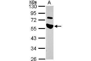 WB Image Sample (30 ug of whole cell lysate) A: A549 10% SDS PAGE antibody diluted at 1:1000 (TRAIP 抗体)