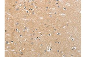 The image on the left is immunohistochemistry of paraffin-embedded Human brain tissue using ABIN7191635(NFASC Antibody) at dilution 1/30, on the right is treated with synthetic peptide. (NFASC 抗体)