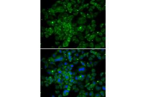 Immunofluorescence analysis of MCF-7 cells using CCL2 antibody (ABIN4903158). (CCL2 抗体)