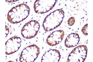 Immunohistochemistry of paraffin-embedded human colon using UCHL3 Rabbit mAb (ABIN1682628, ABIN3015461, ABIN3015462 and ABIN7101429) at dilution of 1:100 (40x lens). (UCHL3 抗体)