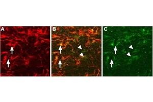 Expression of proNGF in rat brain sectionsImmunohistochemical staining of proNGF in rat brain sections using Anti-proNGF Antibody (ABIN7043556, ABIN7044751 and ABIN7044752).
