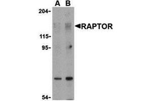 Western Blotting (WB) image for anti-RAPTOR (RAPTOR) (N-Term) antibody (ABIN1031532) (RAPTOR 抗体  (N-Term))
