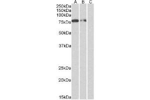 (1 µg/ml, right panel) staining of Multitag protein at 25 ng (A), 10 ng (B) and 5 ng (C) amounts. (Recombinant His Tag 抗体)