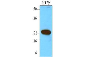 Western Blotting (WB) image for anti-Calcium and Integrin-Binding Protein 1 (CIB1) (AA 1-191), (N-Term) antibody (ABIN238365) (CIB1 抗体  (N-Term))