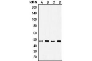 Western blot analysis of IP6K2 expression in A549 (A), H1299 (B), HeLa (C), Raji (D) whole cell lysates. (IP6K2 抗体  (Center))
