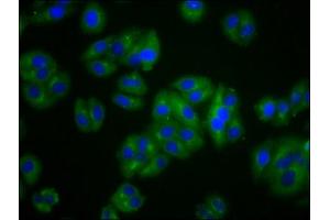 Immunofluorescence staining of HepG2 cells with ABIN7175437 at 1:100, counter-stained with DAPI. (VLDLR 抗体  (AA 133-247))