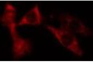 ABIN6275683 staining NIH-3T3 cells by IF/ICC. (WASF3 抗体  (Internal Region))