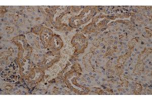 Immunohistochemistry of paraffin-embedded mouse kidney using beta actin Monoclonal Antibody at dilution of 1:200 (beta Actin 抗体)
