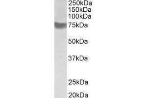 ABIN343748 (1µg/ml) staining of Human Skeletal Muscle lysate (35µg protein in RIPA buffer). (RNF139 抗体  (C-Term))