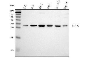 Western blot analysis of 14-3-3 sigma using anti-14-3-3 sigma antibody (ABIN5693156).