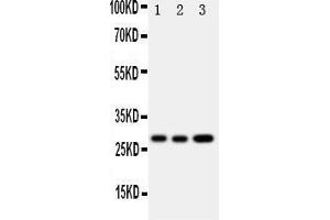 Western Blotting (WB) image for anti-Oncostatin M (OSM) (AA 181-198), (Middle Region) antibody (ABIN3043117) (Oncostatin M 抗体  (Middle Region))