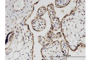 Immunoperoxidase of monoclonal antibody to PRPH on formalin-fixed paraffin-embedded human placenta.