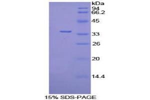 SDS-PAGE analysis of Mouse PDK4 Protein. (PDK4 蛋白)
