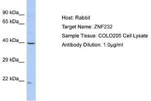 Host: Rabbit Target Name: ZNF232 Sample Type: COLO205 Whole cell lysates Antibody Dilution: 1. (ZNF232 抗体  (N-Term))
