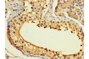 Immunohistochemistry of paraffin-embedded human testis tissue using ABIN7155297 at dilution of 1:100 (ASF1B 抗体  (AA 1-202))