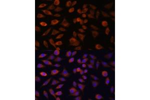 Immunofluorescence analysis of L929 cells using TRIM47 antibody (ABIN7270991) at dilution of 1:100. (TRIM47 抗体  (AA 356-530))