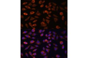 Immunofluorescence analysis of L929 cells using TRIM47 antibody (ABIN7270991) at dilution of 1:100. (TRIM47 抗体  (AA 356-530))