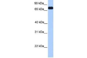 Transfected 293T; WB Suggested Anti-PRICKLE3 Antibody Titration: 0. (PRICKLE3 抗体  (C-Term))