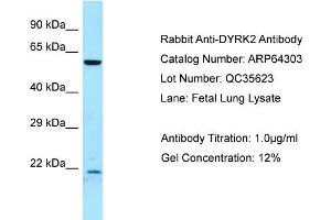 Western Blotting (WB) image for anti-Dual-Specificity tyrosine-(Y)-phosphorylation Regulated Kinase 2 (DYRK2) (C-Term) antibody (ABIN2789799) (DYRK2 抗体  (C-Term))