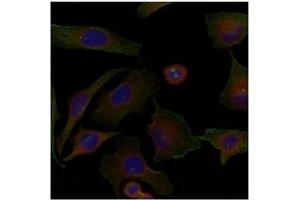 Image no. 2 for anti-Family with Sequence Similarity 129, Member A (FAM129A) (AA 908-920) antibody (ABIN197598) (Niban 抗体  (AA 908-920))