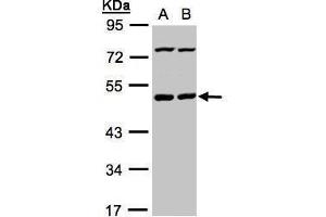 WB Image Sample(30 ug whole cell lysate) A:HeLa S3, B:Hep G2 , 10% SDS PAGE antibody diluted at 1:1000 (PSKH1 抗体)
